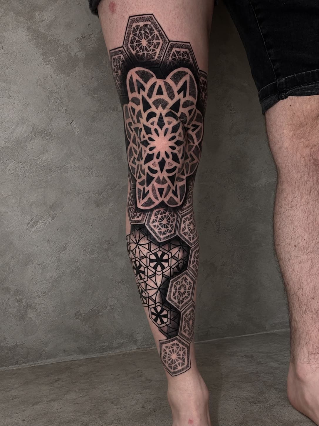Articular Knee Mandala